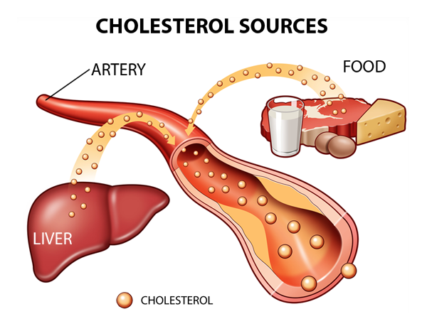 bad and good cholesterol