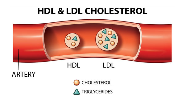 hdl vs ldl structure